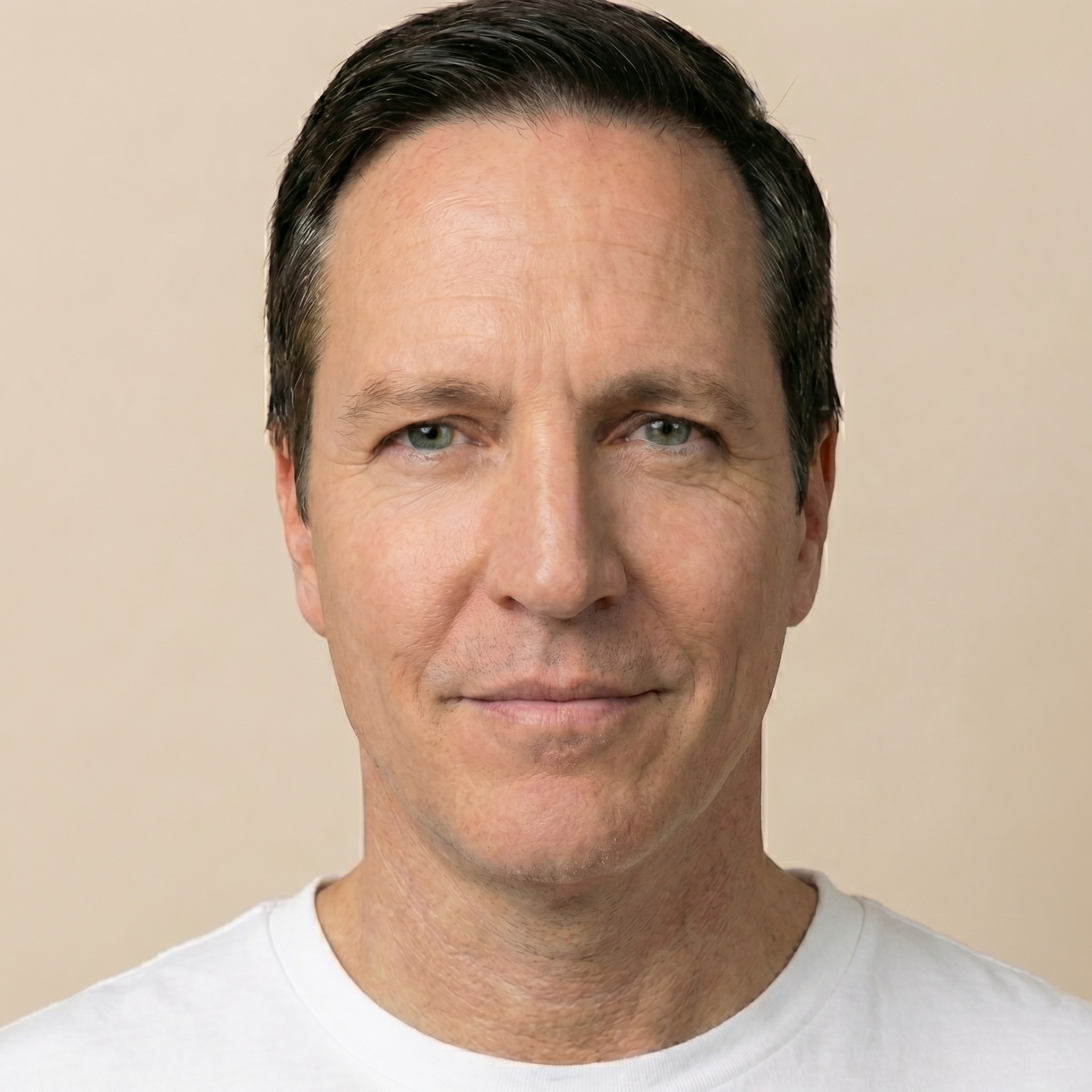 Arran, 48, undefined, after 12 weeks with DermLens AI personalised skincare routine — fine lines & texture improvement
